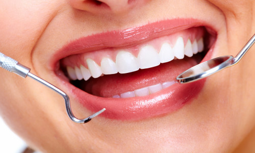 Oral Checkup